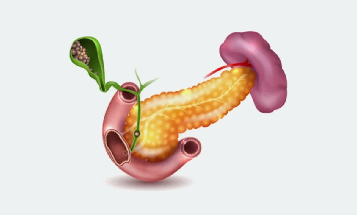 Gallbladder Cancer
