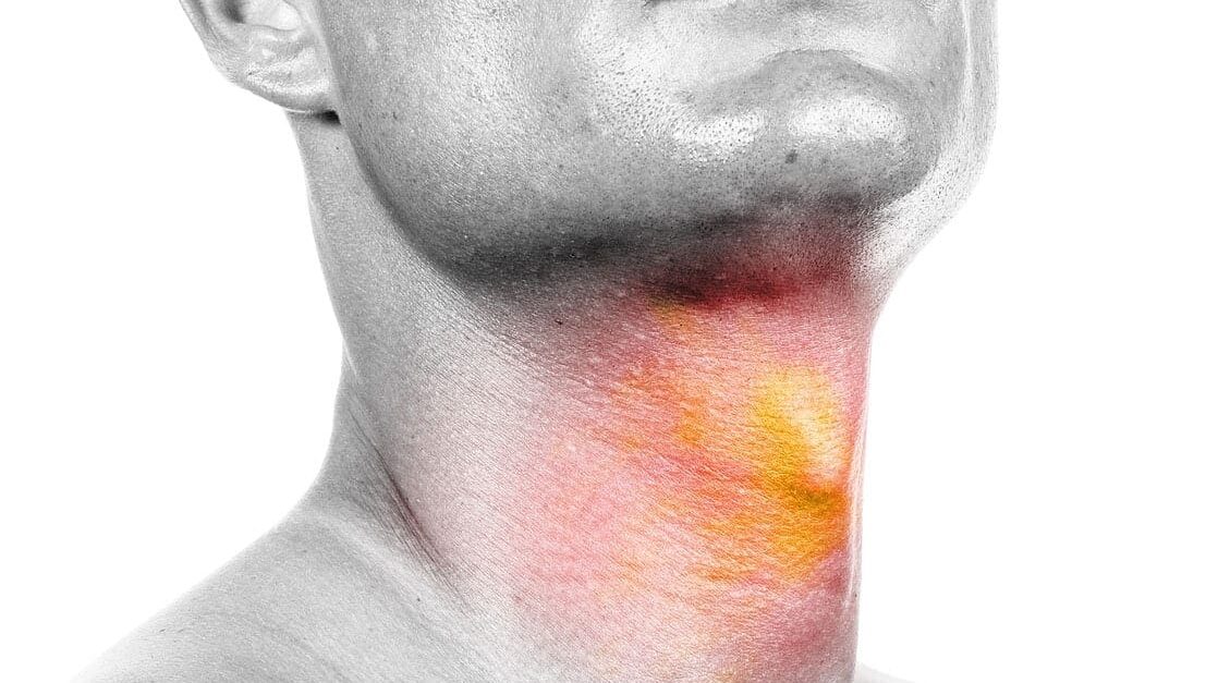 What You Should Know About Oral, Head, and Neck Cancer