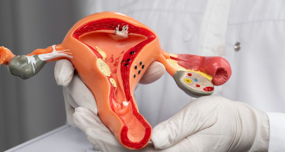 What Are the First Signs of Cervical Cancer in Ahmedabad