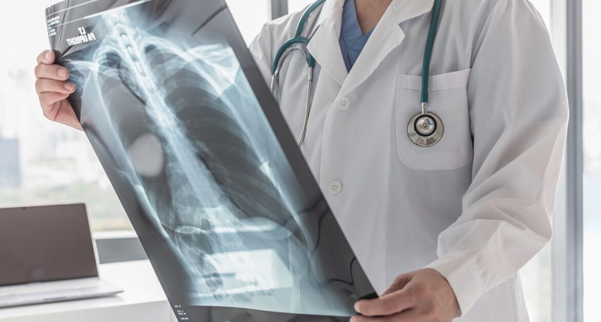 Lung Cancer in Ahmedabad Treatment Outcomes, Quality of Life, and the Power of Early Diagnosis