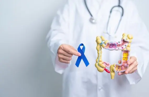 Colon Cancer Early Symptoms, Stages and Causes
