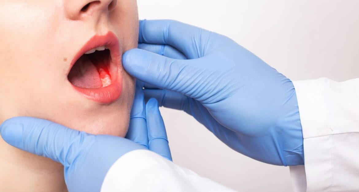 Comprehensive Oral Cancer Treatment in Ahmedabad at Airavat Cancer Care