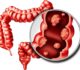When to See a Doctor: Signs of Colon Cancer You Shouldn’t Ignore