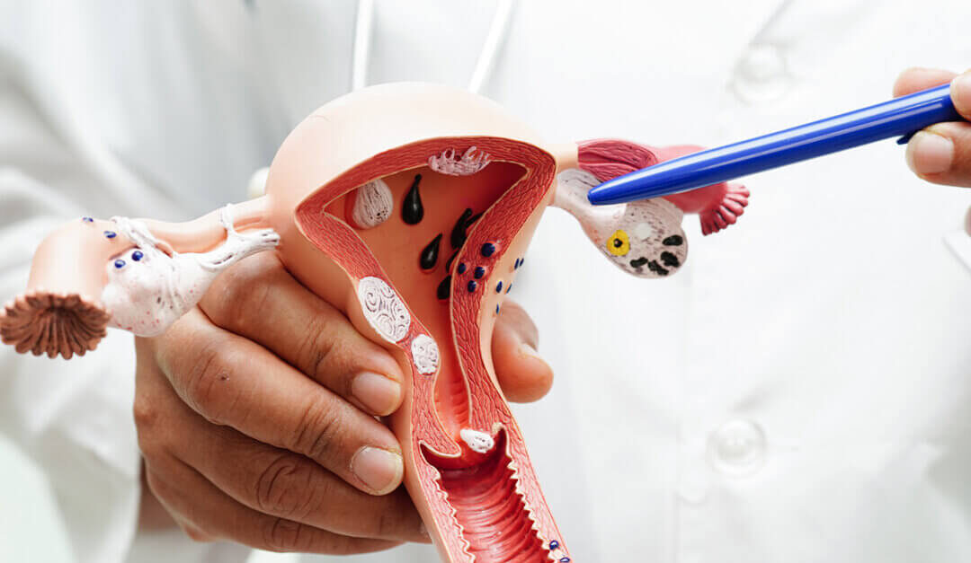 Understanding the Gynecologic Cancer in Ahmedabad