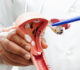 Understanding the Gynecologic Cancer in Ahmedabad: What Every Woman Should Know
