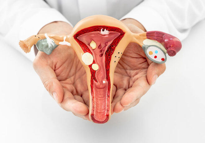 Gynec Cancer Surgeon in Ahmedabad