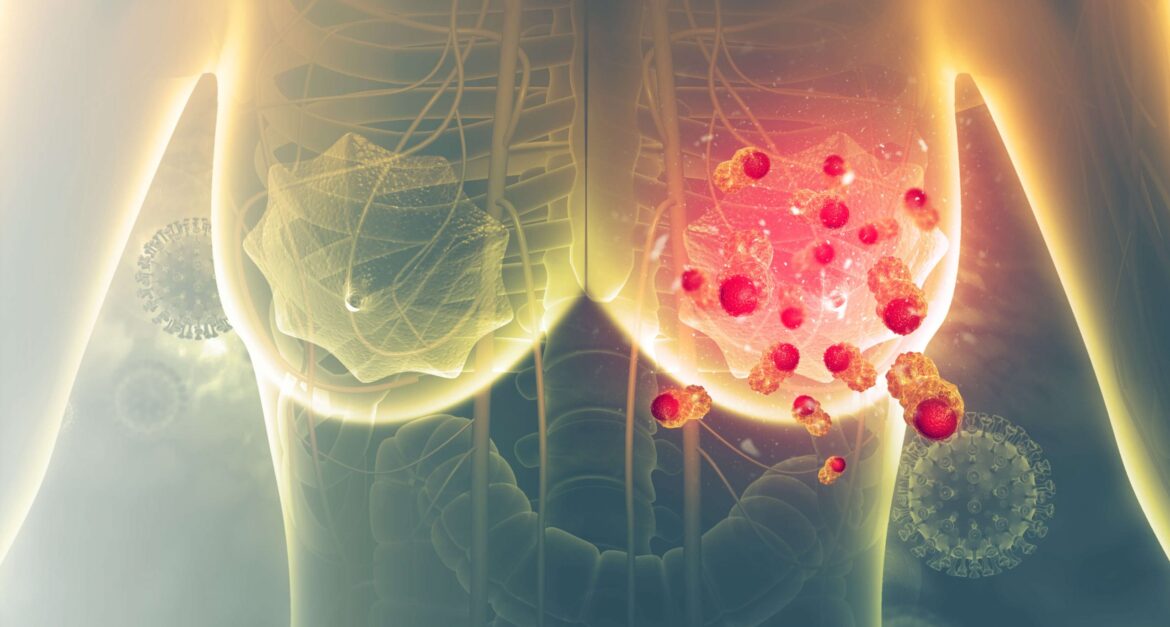 breast cancer doctor in Ahmedabad