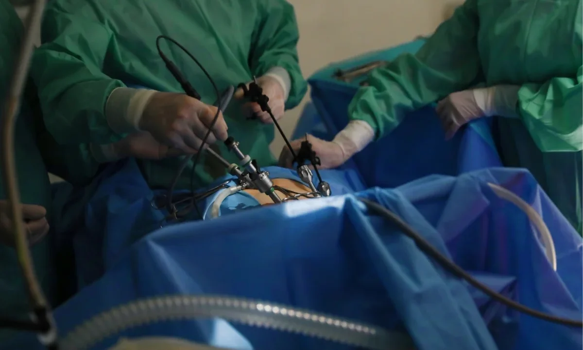 Laparoscopic Cancer Surgery