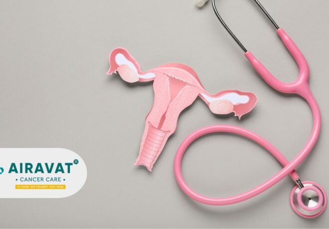 Ovarian Cancer: Understanding the Disease, Diagnosis, and Modern Treatment Options