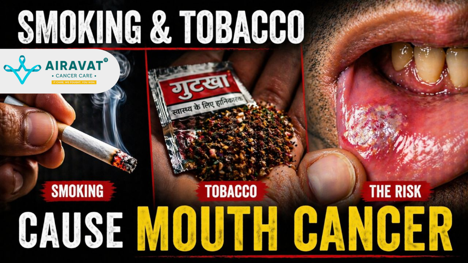 How Tobacco and Smoking Affect Oral Cancer Risk