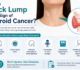 Can a Neck Lump Be a Sign of Thyroid Cancer?
